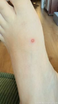 ���˵ĽŽ�[1P]